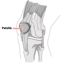 Patella