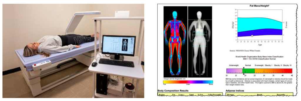 body composition